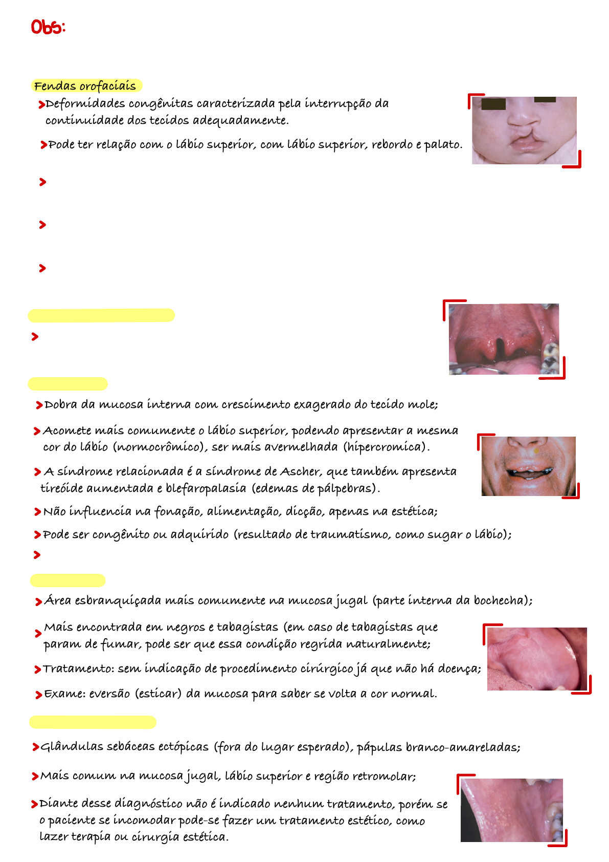 tempo de cicatrizao exciso mcula melantica lbio inferior com pontos Postei esse caso h algum tempo, destacando a importncia da diascopia ou vitropresso, como manobra semiotcnica utilizada na diferenciao leses vasculares de pigmentadas. Me pediram um retorno quanto ao diagnstico e Manchas Escuras nos Lbios: O