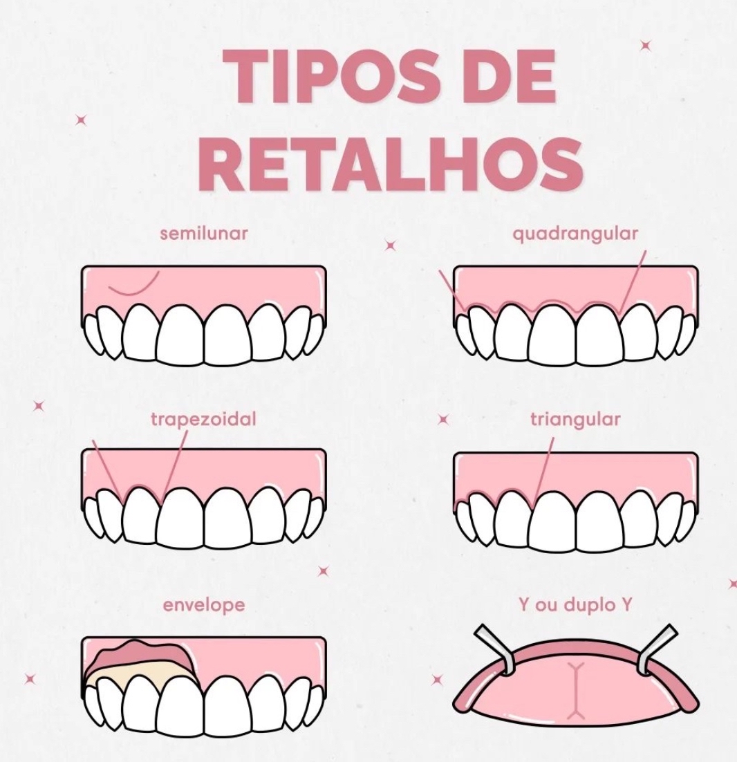 Periodontia - Periodontia