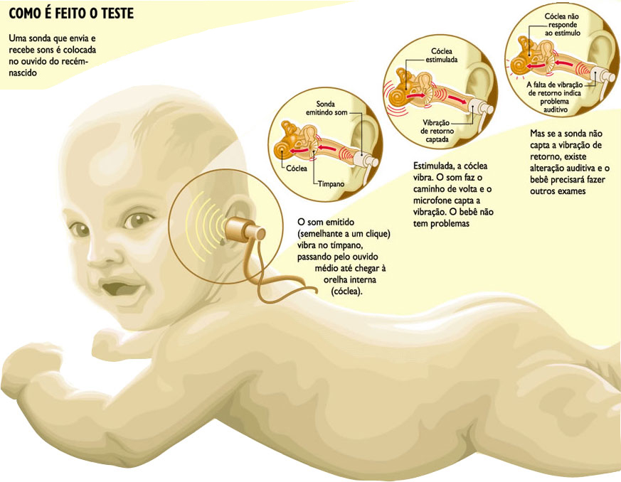 Audiologia infantil - TRIAGEM AUDITIVA NEONATAL REALIZADA AINDA NA  MATERNIDADE (24-48HS) OU ATÉ O - Studocu