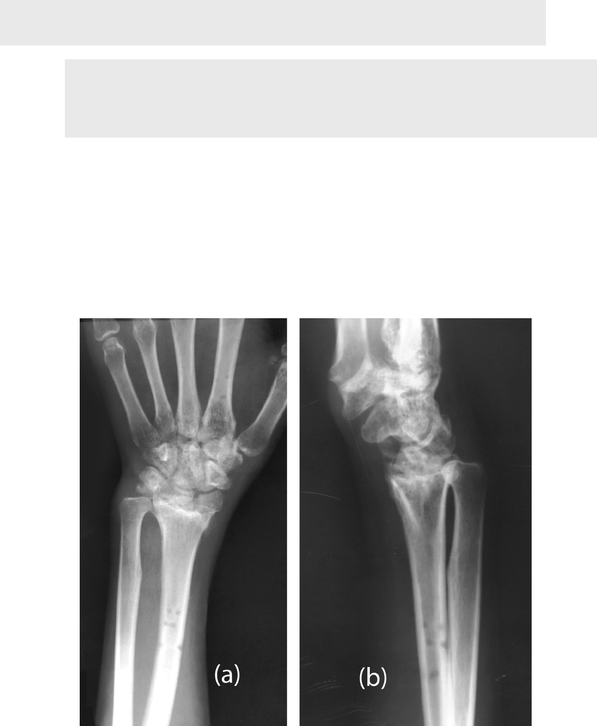 Spine Hospitalar (@spinehospitalar) • Instagram photos and videos, image size:1206x1467