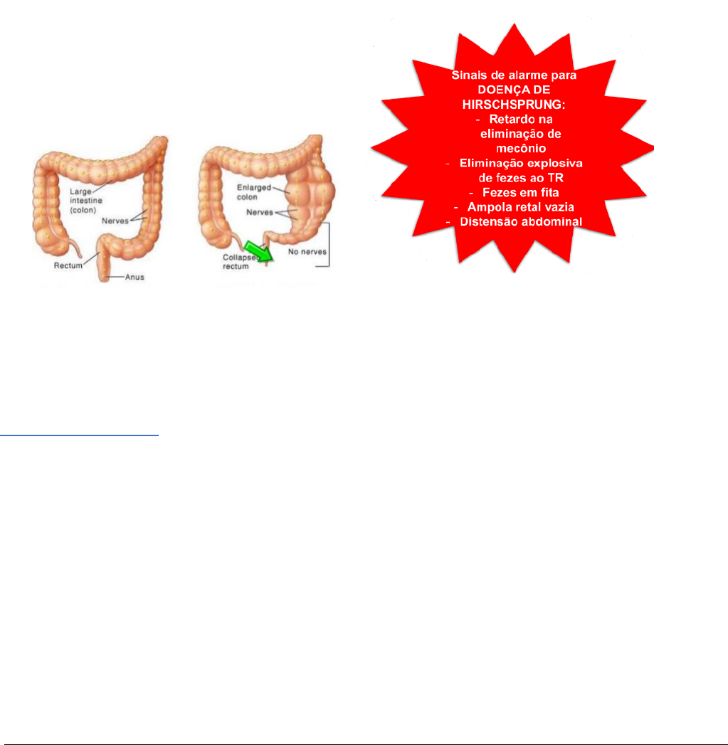 Grátis: Constipação Intestinal - Material Claro e Objetivo em PDF para  Estudo Rápido, image size:1023x1047