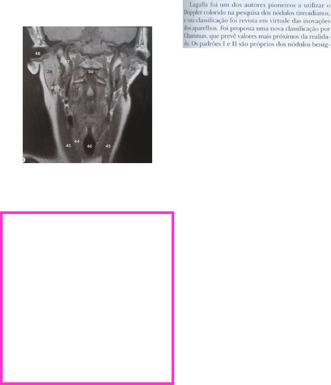 LINFADENOPATIAS - GESEP, image size:1092x1270