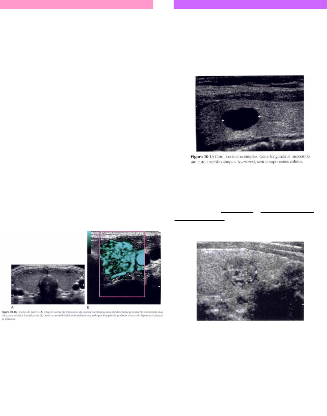 Tratamento do cisto tireoglosso | TikTok, image size:1053x1340