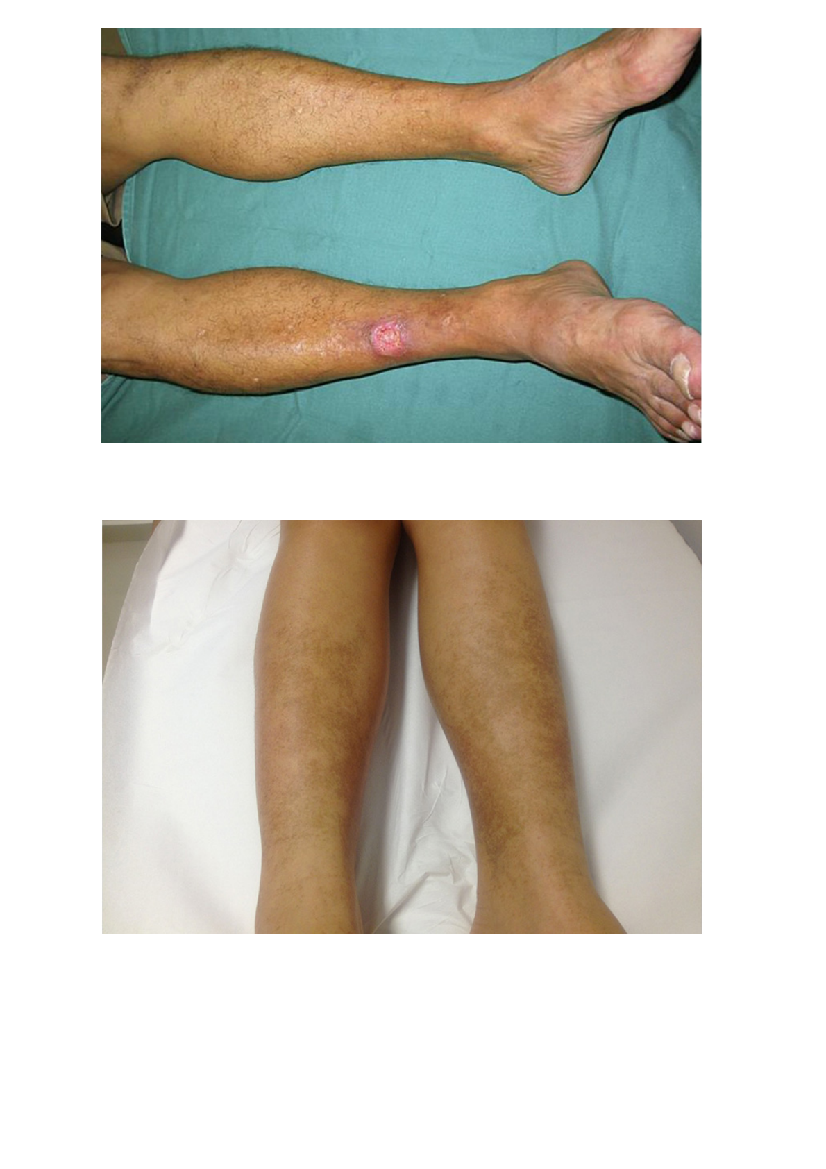 Grátis: Capítulo 08 - Manifestações dermatológicas do Diabetes - Material  Claro e Objetivo em PDF para Estudo Rápido, image size:1190x1684