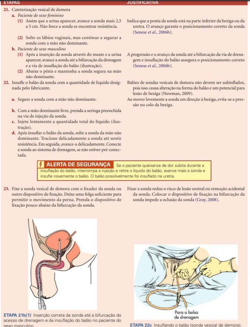 Grátis: Atividade sobre Sonda Vesical de demora e Sonda vesical de alívio -  Material Claro e Objetivo em PDF para Estudo Rápido