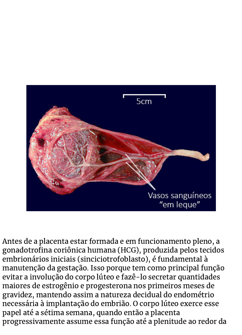 GORRO DE CROCHE PARA BEBE COM TABELA DE MEDIDA E GRÁFICO, image size:936x1296