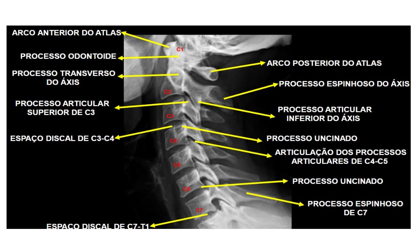 Grátis: COLUNA VERTEBRAL TR 01 - Material Claro e Objetivo em PDF para  Estudo Rápido, image size:1440x810