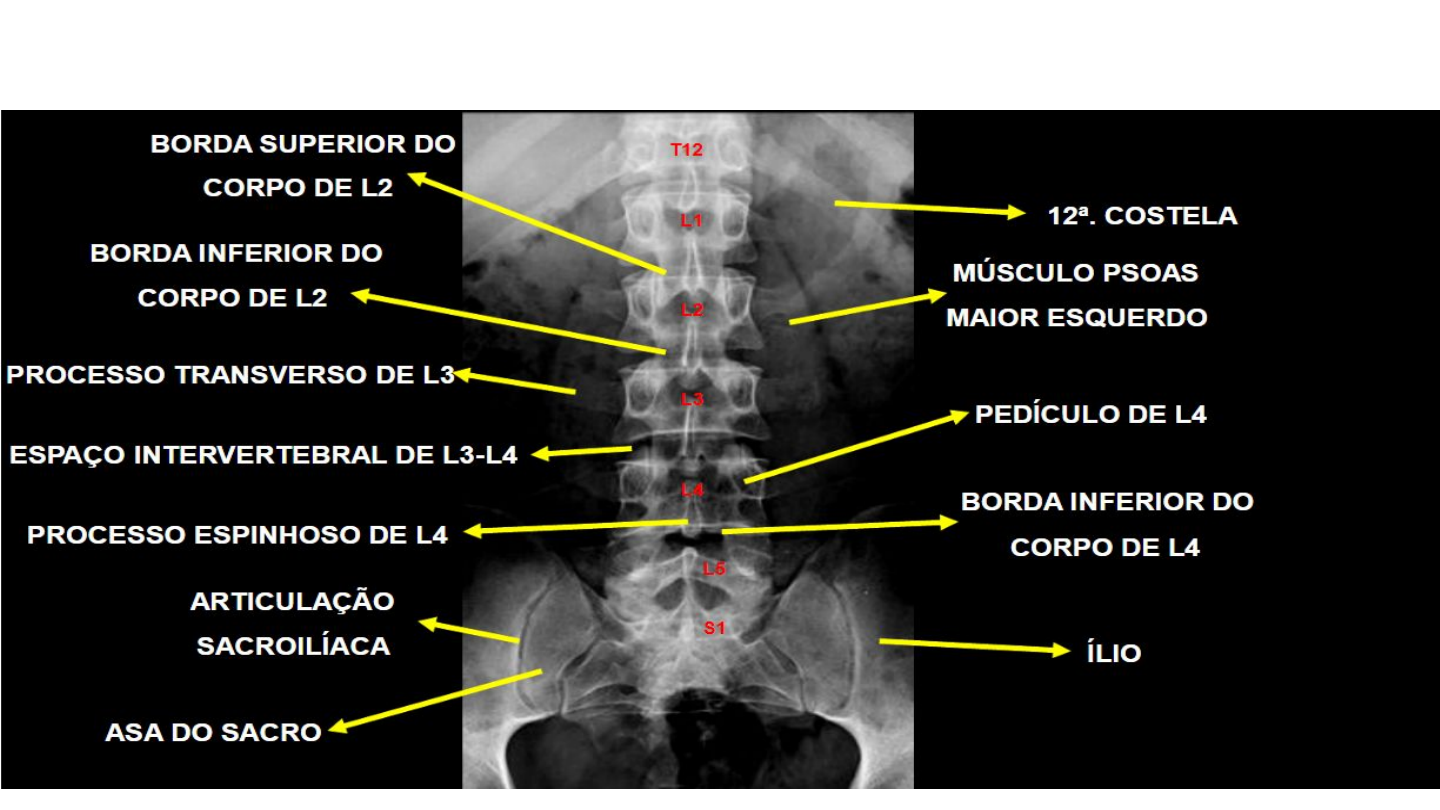 Grátis: COLUNA VERTEBRAL TR 01 - Material Claro e Objetivo em PDF para  Estudo Rápido, image size:1440x810