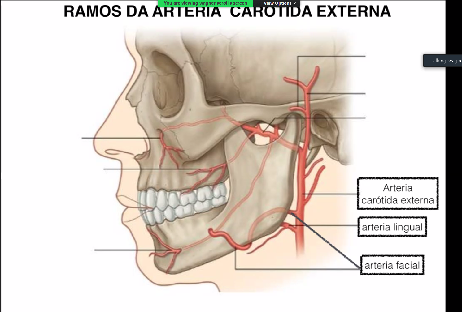 A maxillaris. Наружная верхнечелюстная артерия. A. maxillaris – верхнечелюстная артерия. Нижнечелюстная артерия анатомия. Верхнечелюстная артерия схема.