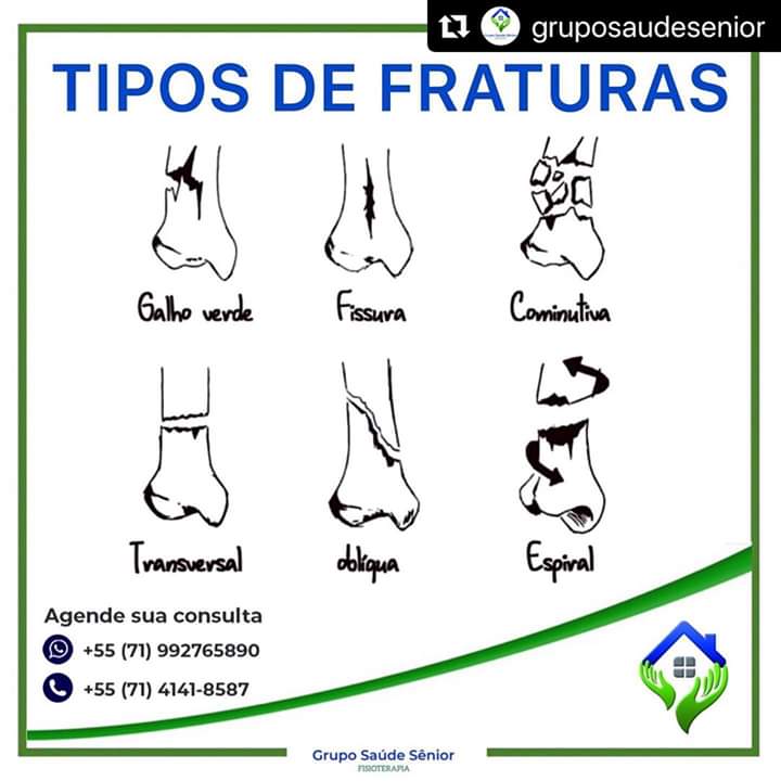 Tipos de Fratura - Fisioterapia Ortopédica