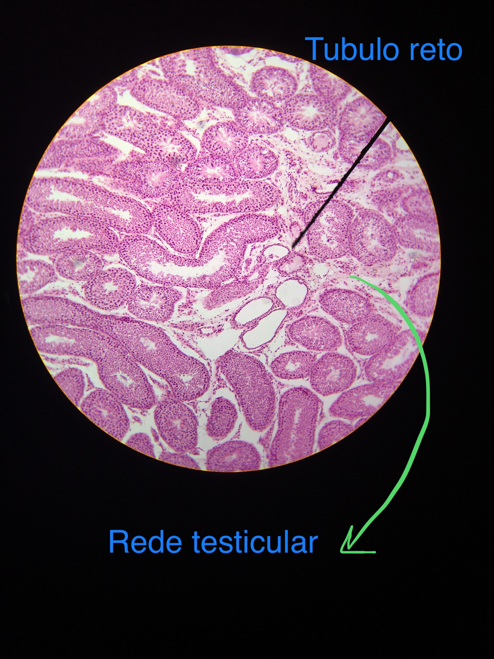 histología testicular