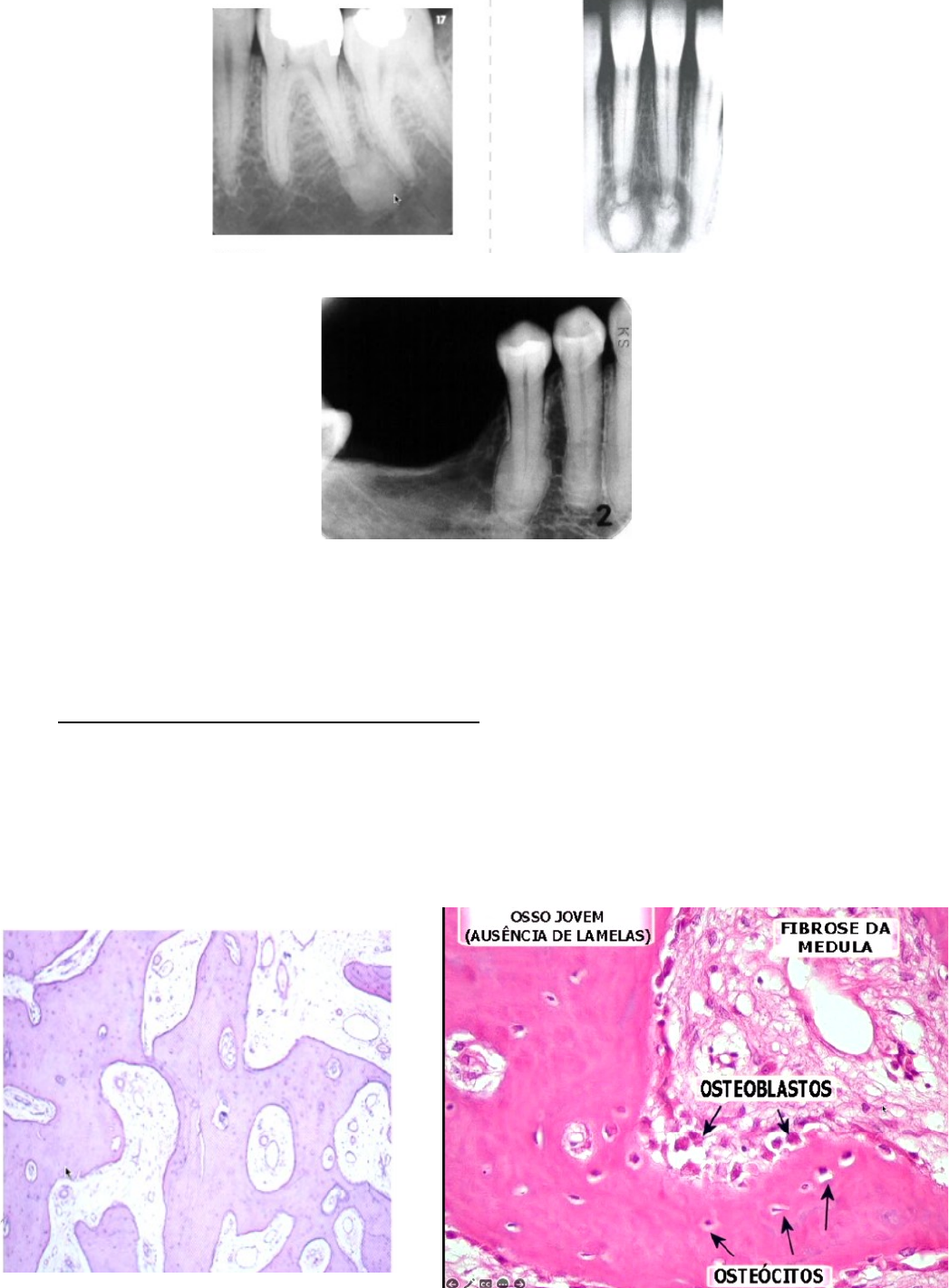 Grátis: Lesões Radiopacas - Material Claro e Objetivo em PDF para Estudo  Rápido, image size:1047x1421