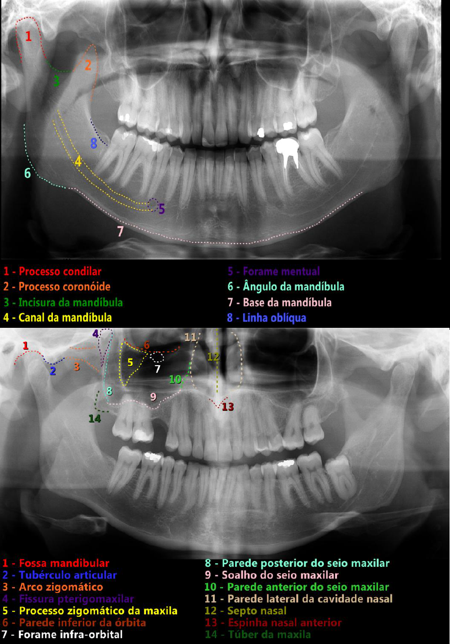 Panoramica anatomia Radiologia