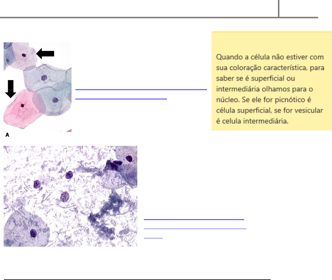 Aula 04 EPITÉLIO ESCAMOSO - Citologia Ginecologica