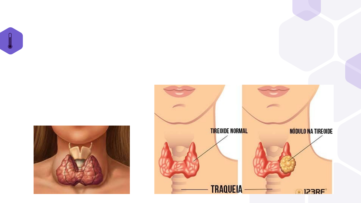 Médico Meia Idade Amigável Verificando Dor Garganta Glândulas Tireoidianas  Tocando — Foto © Milkos #651944692, image size:1440x810