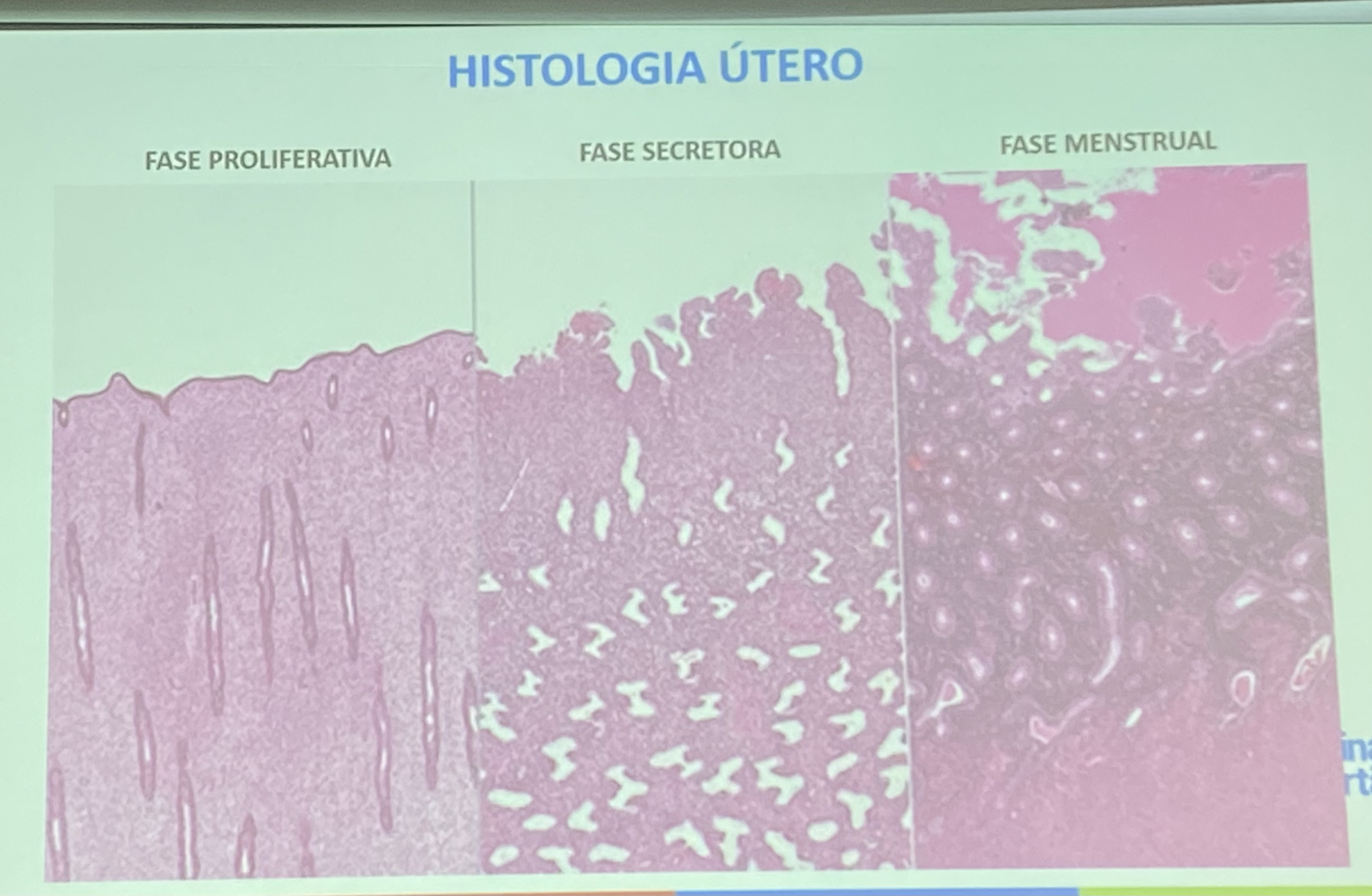 histología de la fase menstrual del útero