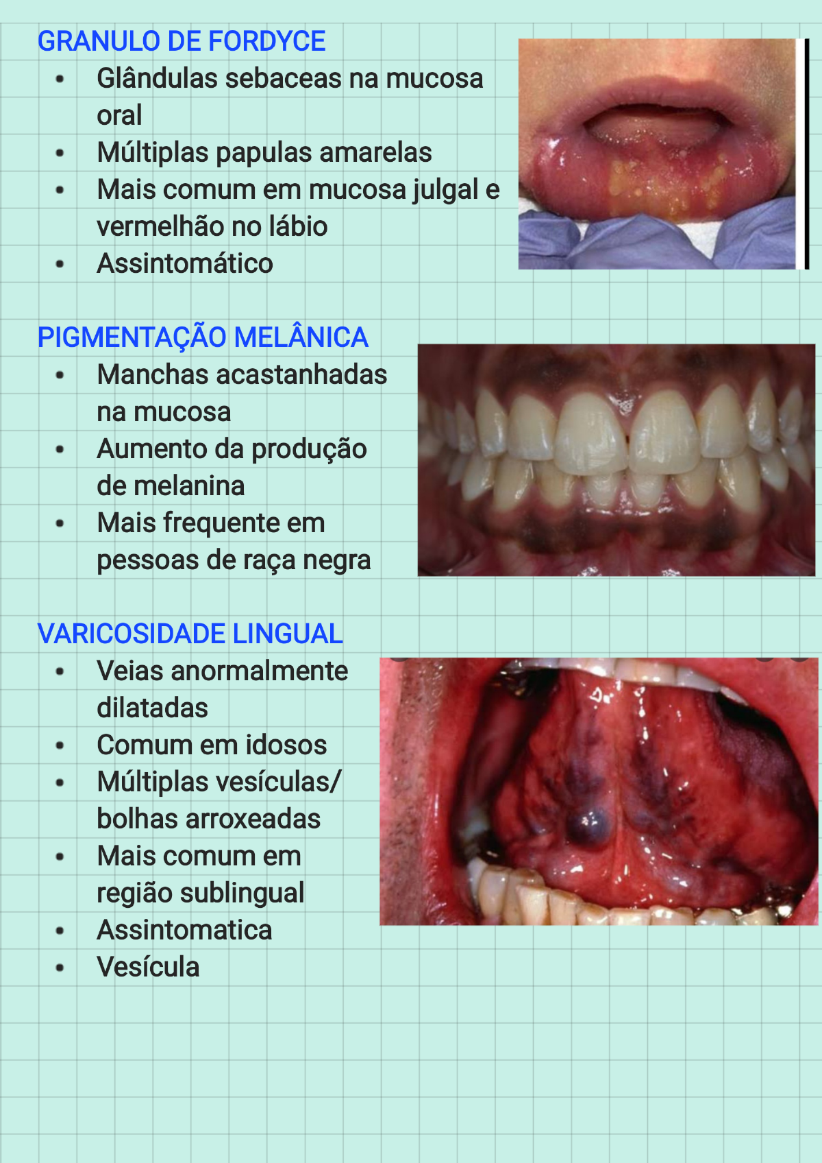 Diferenças Anatômicas Orais Não Patologicas 221022 100648 Semiologia Odontológica 0743