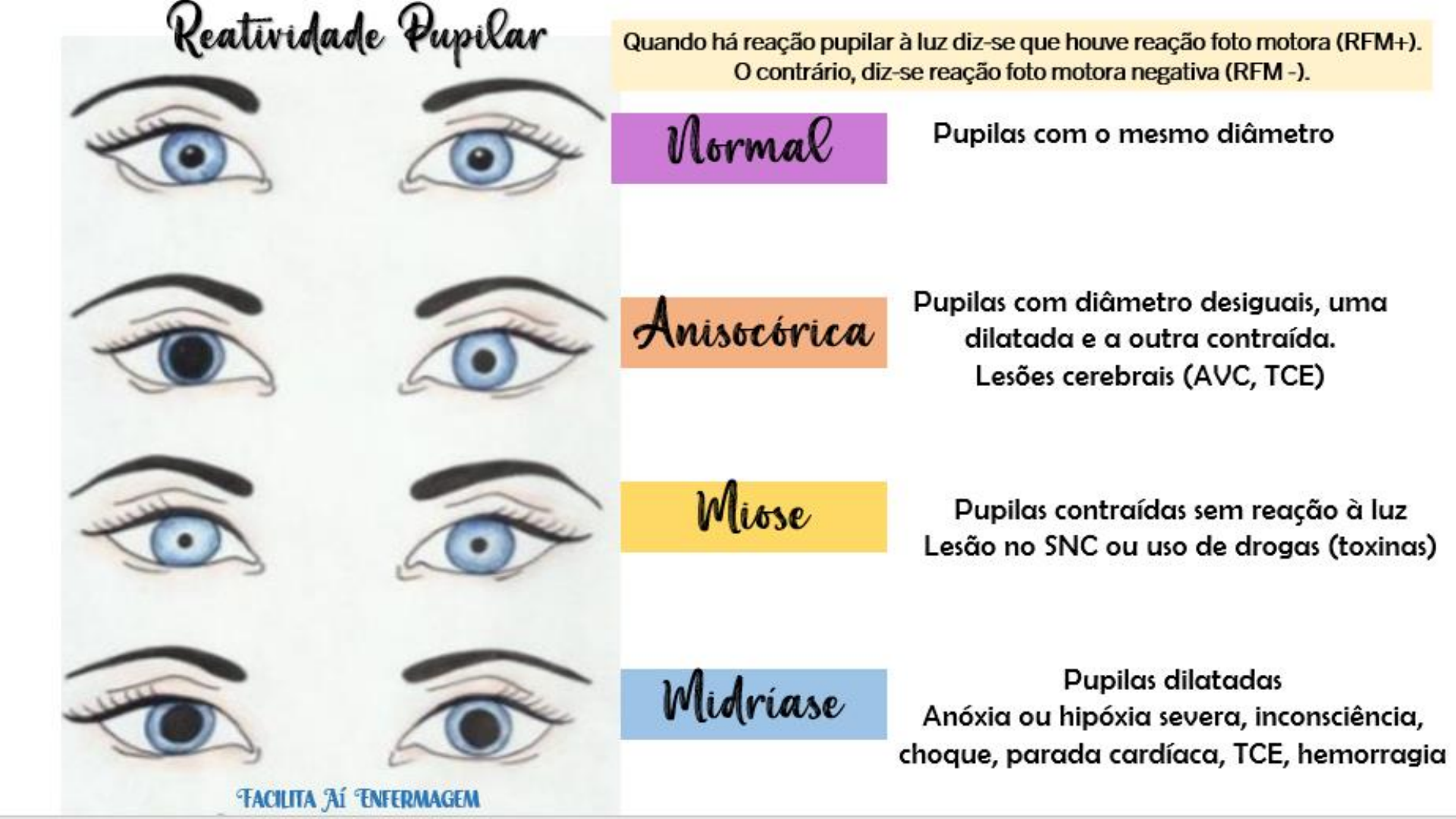 Pupilas N o Fotorreagentes O Que Significa BRAINCP