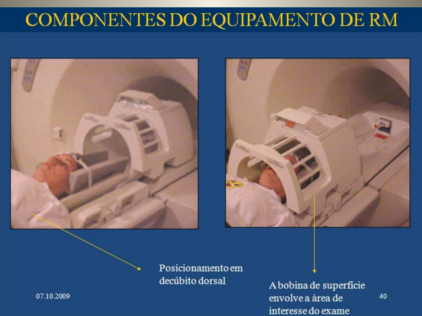 Grátis: Aula 2 - Hipertensao intracraniana - Material Claro e Objetivo em  PDF para Estudo Rápido, image size:1440x1080