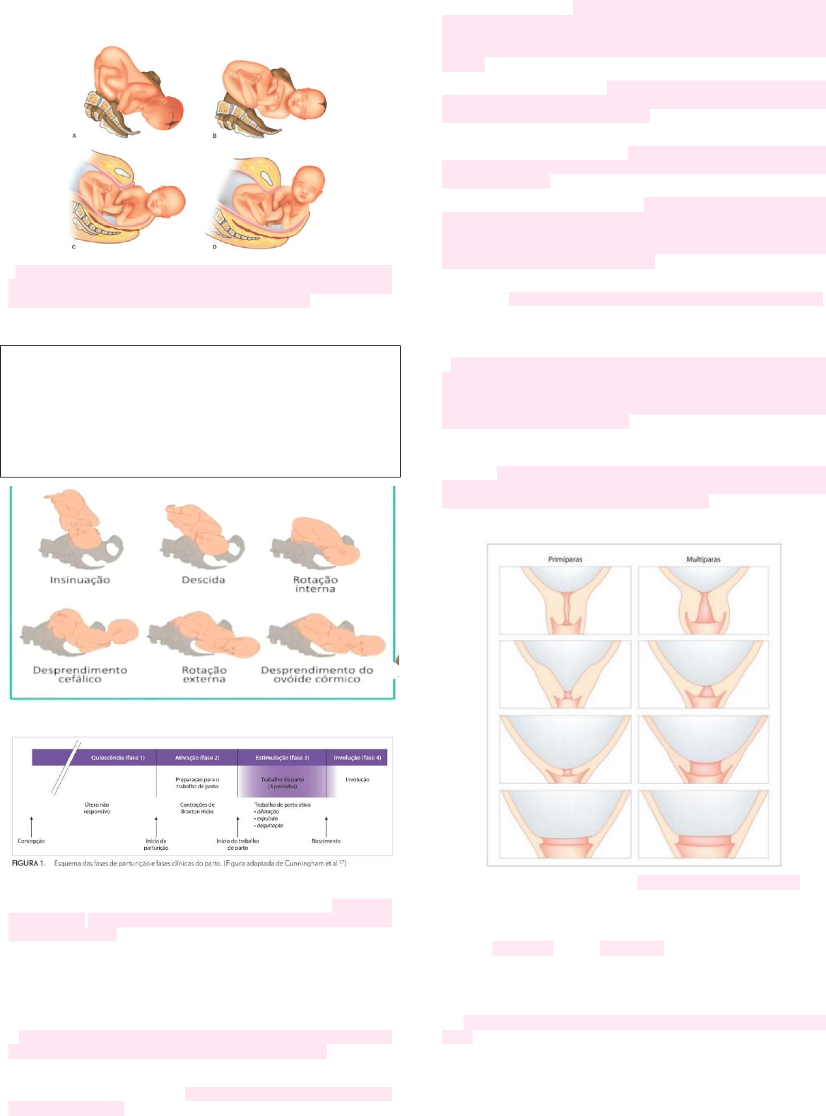 Grátis: SP3 - Mecanismo de parto - Diabetes gestacional - Material Claro e  Objetivo em PDF para Estudo Rápido, image size:1169x1580