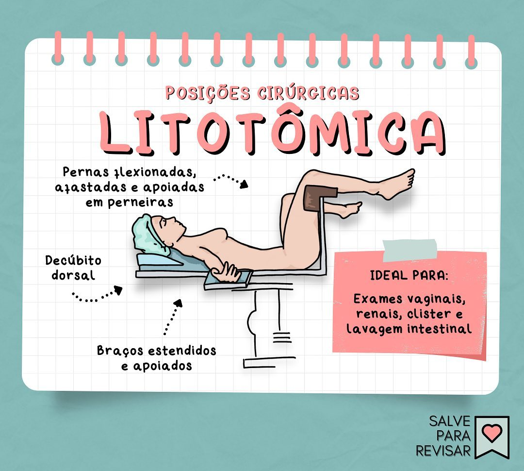 Litotômica Enfermagem