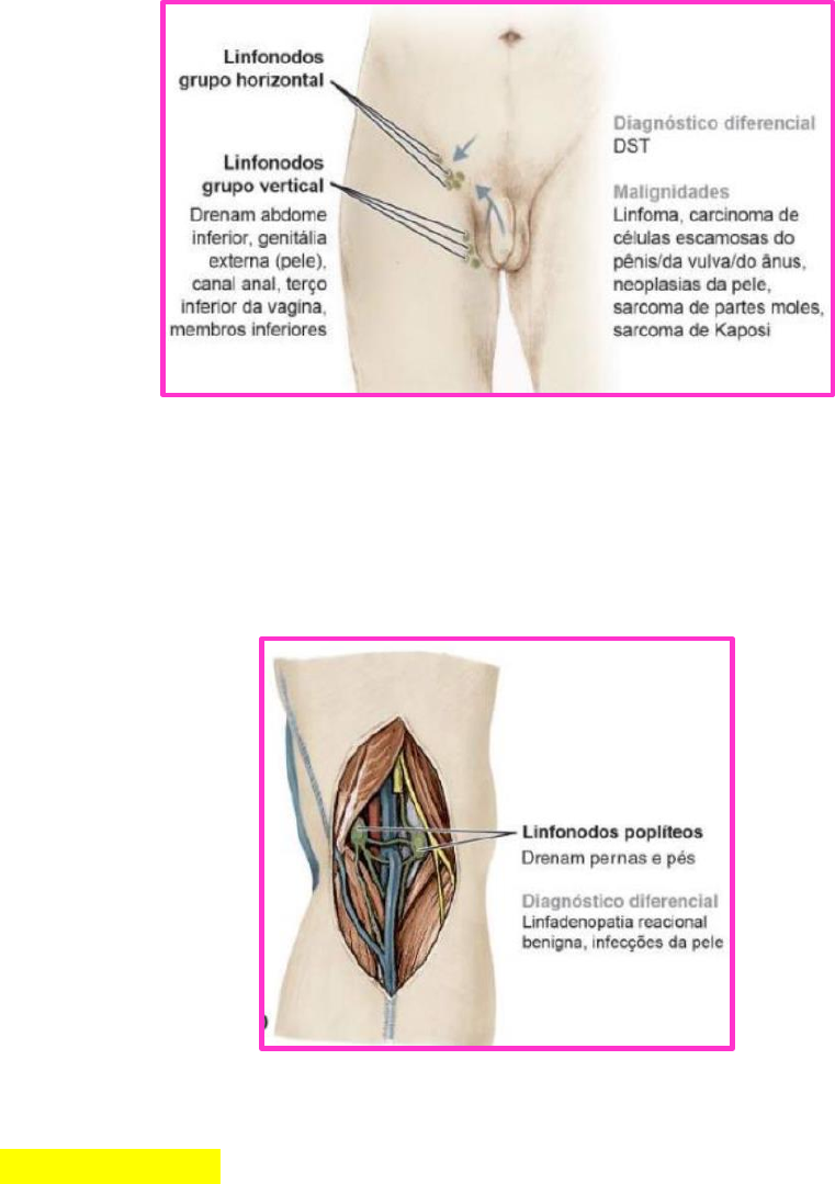 Grátis: ADENOMEGALIAS - Material Claro e Objetivo em PDF para Estudo Rápido, image size:761x1079
