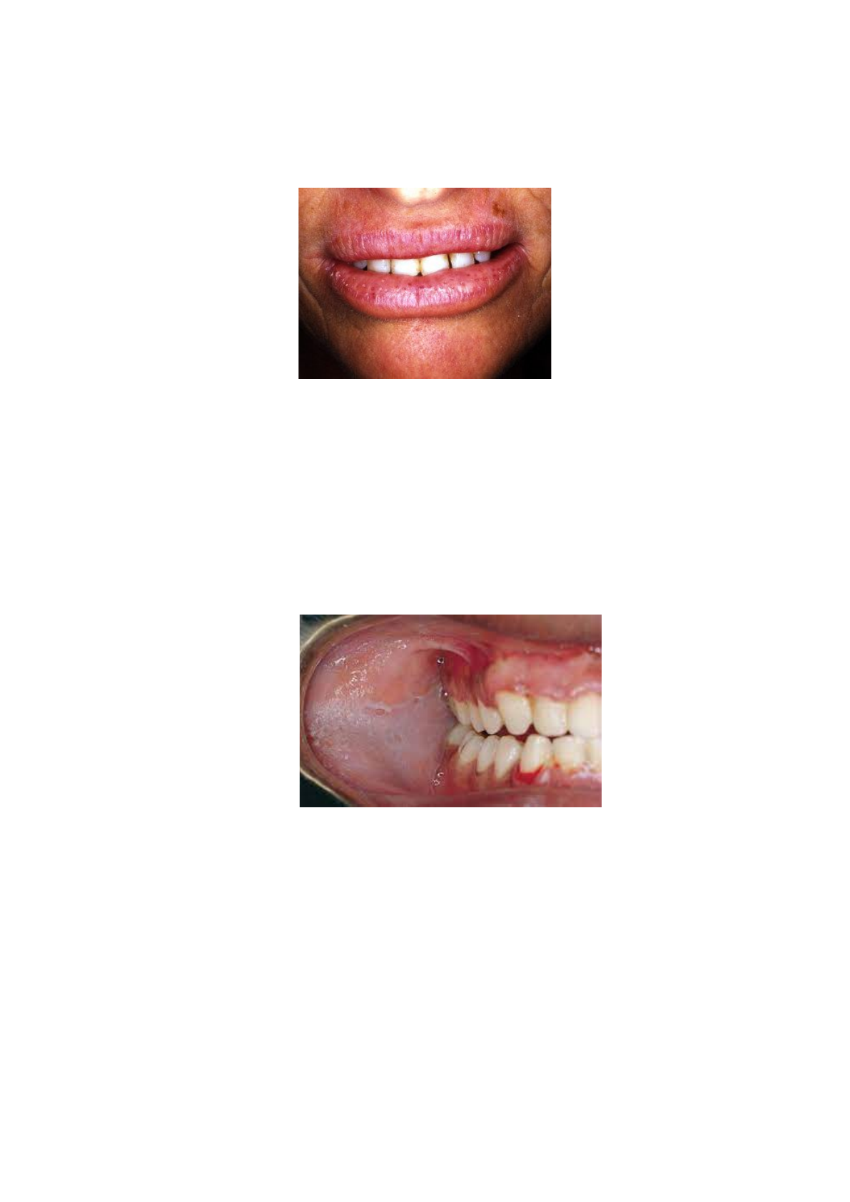 Grátis: variações da normalidade e lesões fundamentais - Material Claro e  Objetivo em PDF para Estudo Rápido, image size:1191x1684