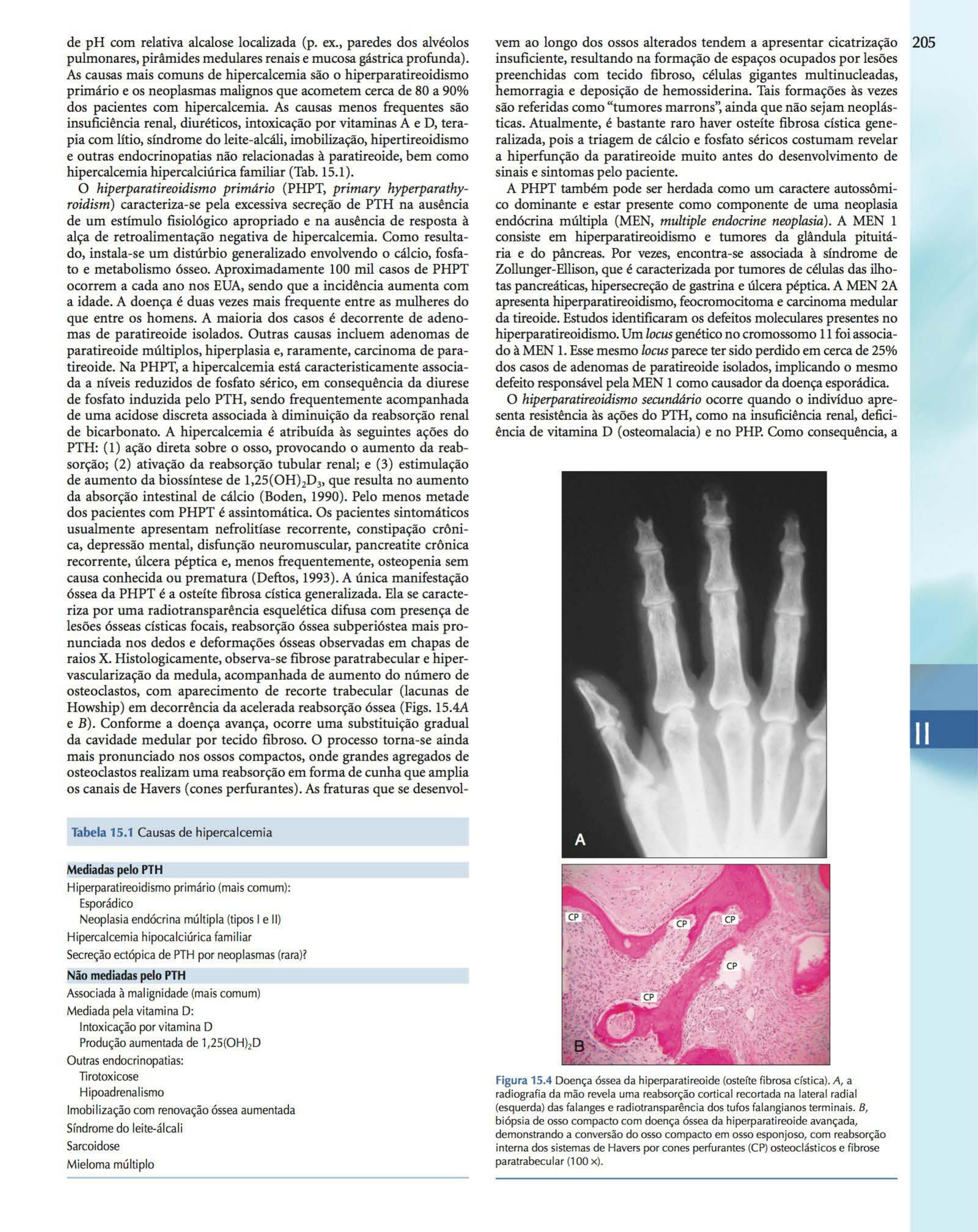 osteíte fibrosa cística radiografia