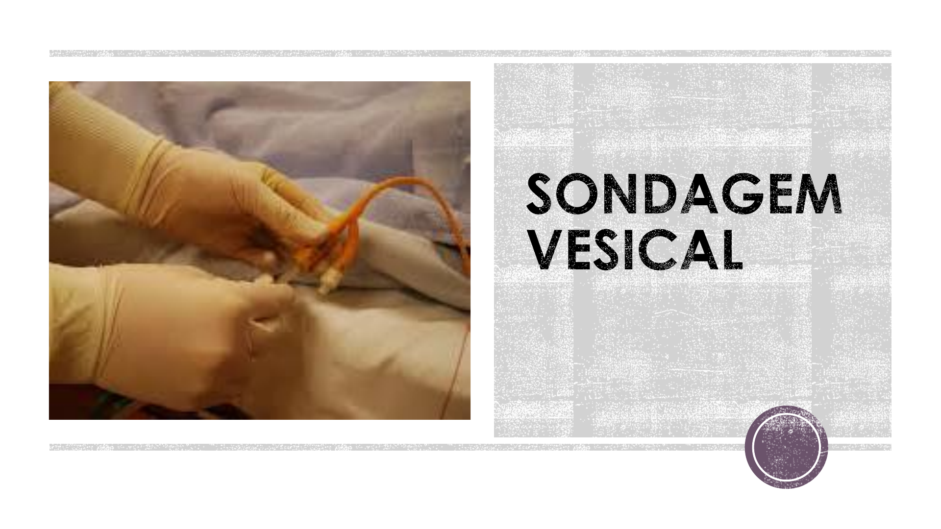 Grátis: Aula 4 Sondagem e irrigação vesical - Material Claro e Objetivo em  PDF para Estudo Rápido