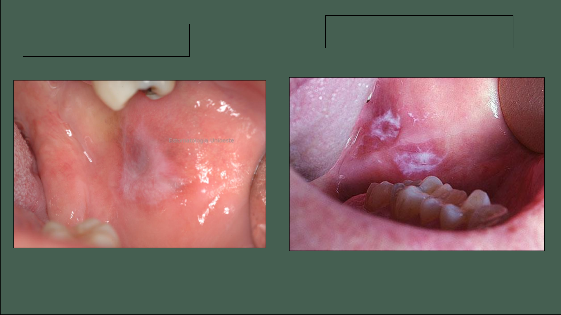 Grtis: ALTERAOES DE COR DA MUCOSA BUCAL E DOS diagnostico - Copia -  Material Claro e Objetivo em PDF para Estudo Rpido