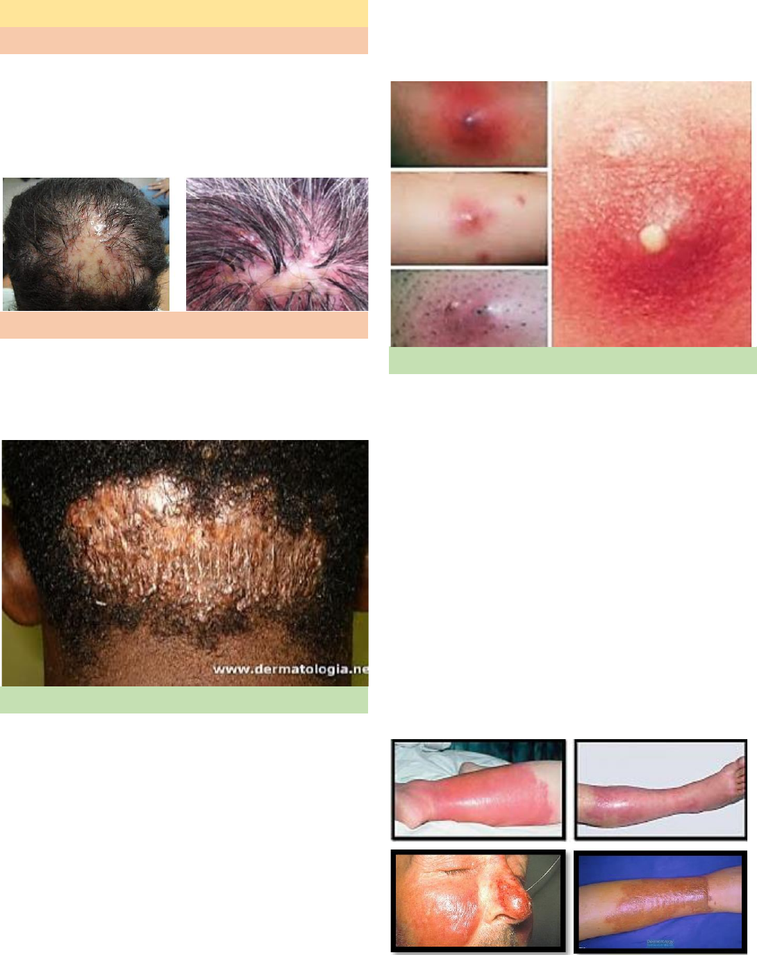 Dermatoses por agentes biológicos - Dermatologia