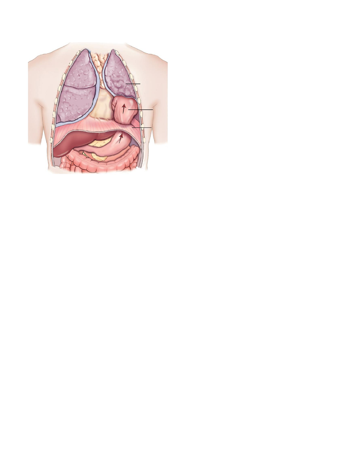 PHTLS - Cap 11 Trauma Abdominal - Emergências