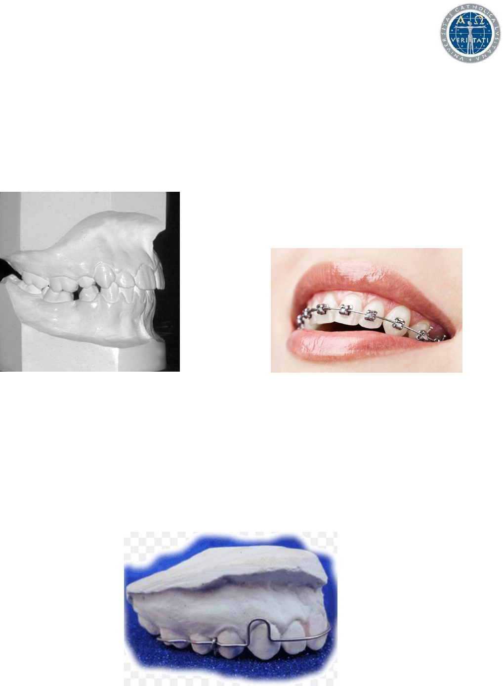 Ortodontia - APIO