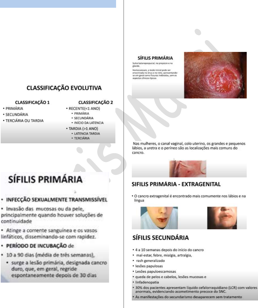 Lingua De Sifilis Primaria Clinical Manifestations Of Syphilis In The