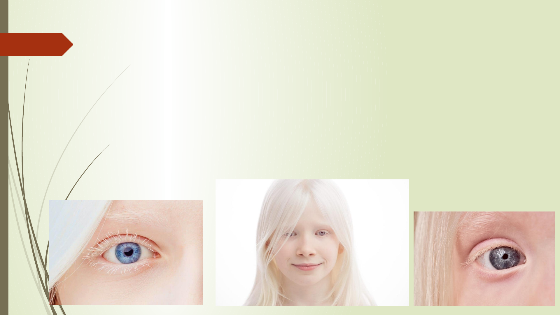 Poster Cientifico - Albinismo | PDF | Alelo | Dominância (genética), image size:1920x1080