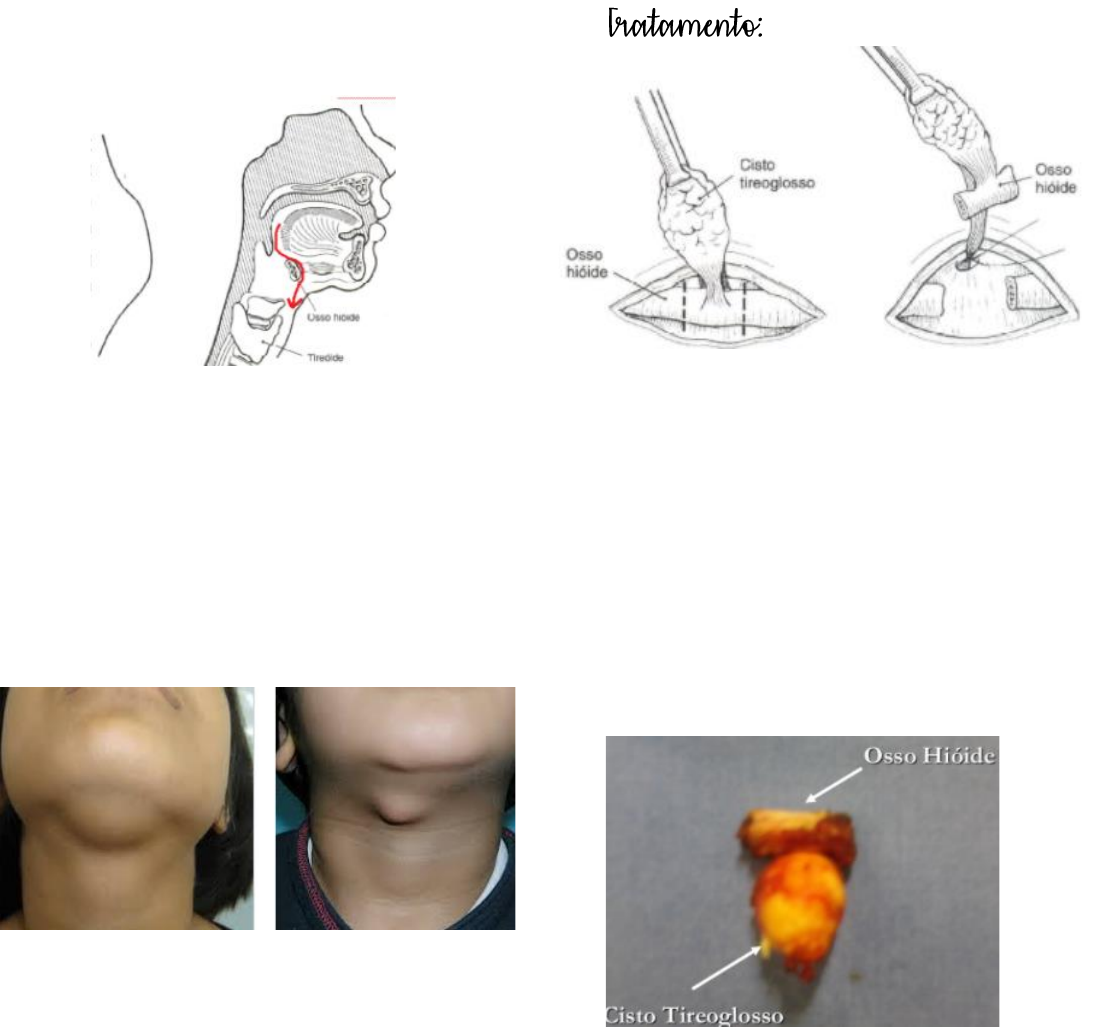 Grátis: Patologias da Região Cervical - Material Claro e Objetivo em PDF  para Estudo Rápido, image size:1112x1027