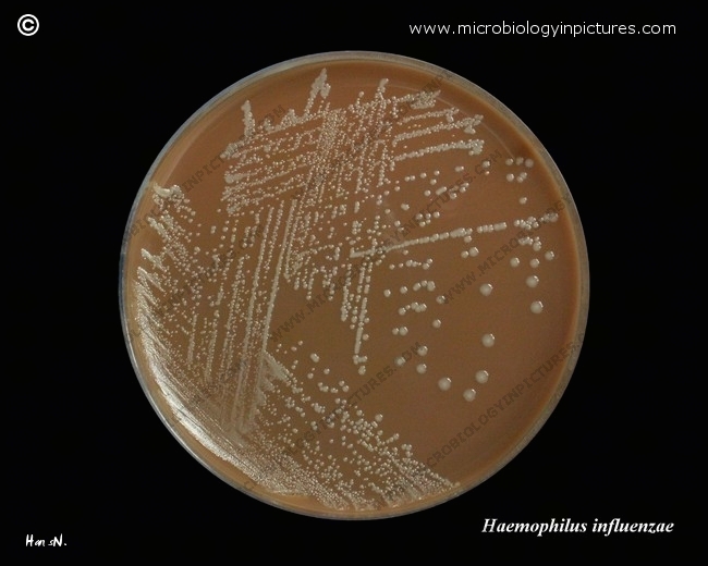 haemophilus influenzae 02