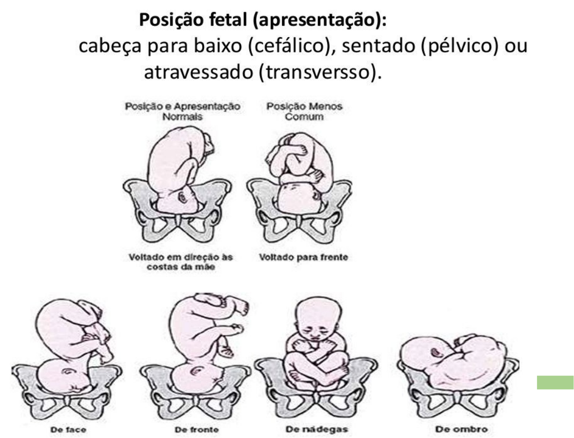 Felipefeitosabrasil - Posição correta da cabeça no supino. . . Um