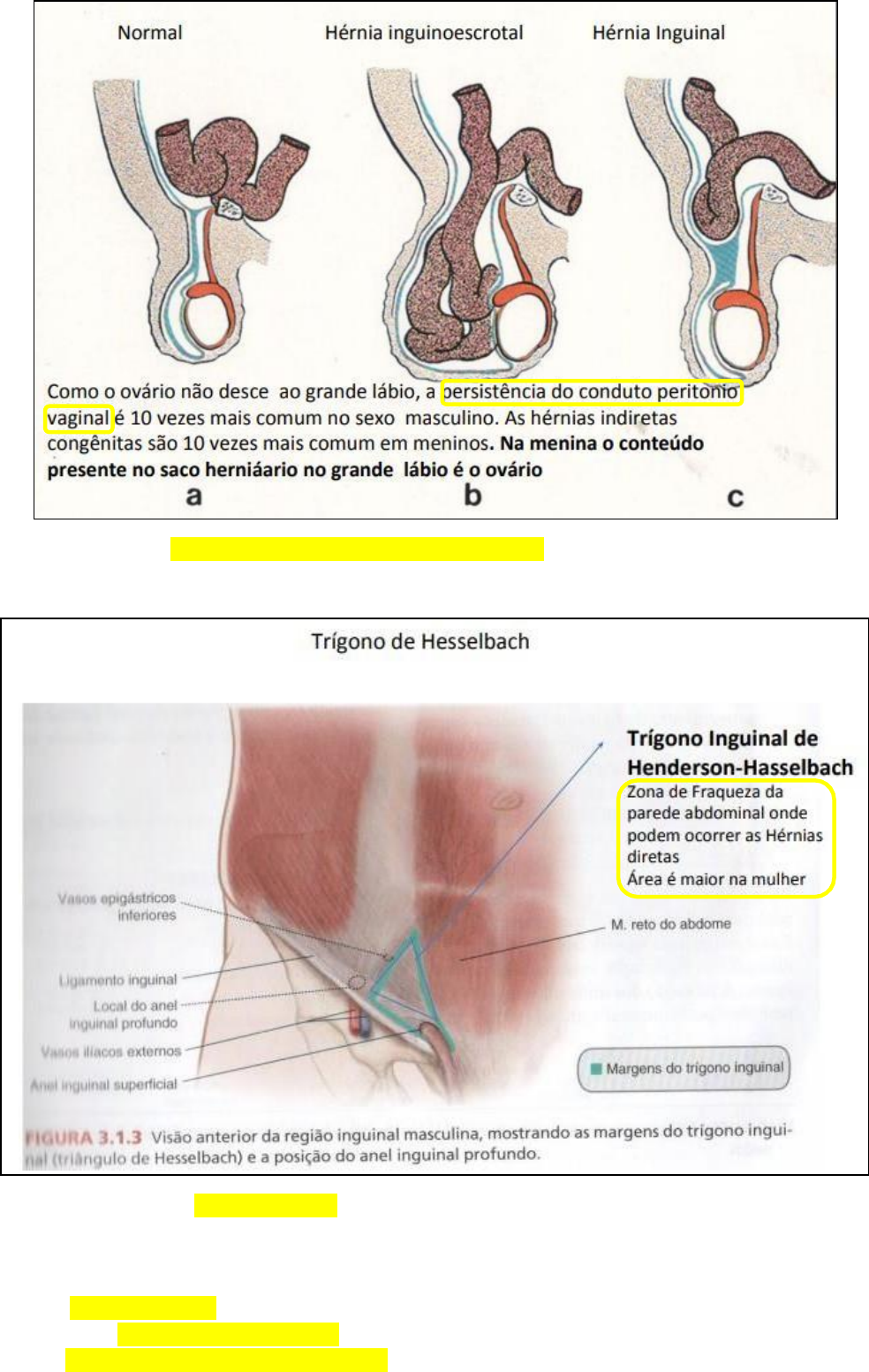 Clínica Giovanardi - A hérnia inguinal se caracteriza como uma protusão de  uma pequena parte do intestino, de um tecido adiposo ou de outros órgãos  pela parede abdominal na região inguinal direita