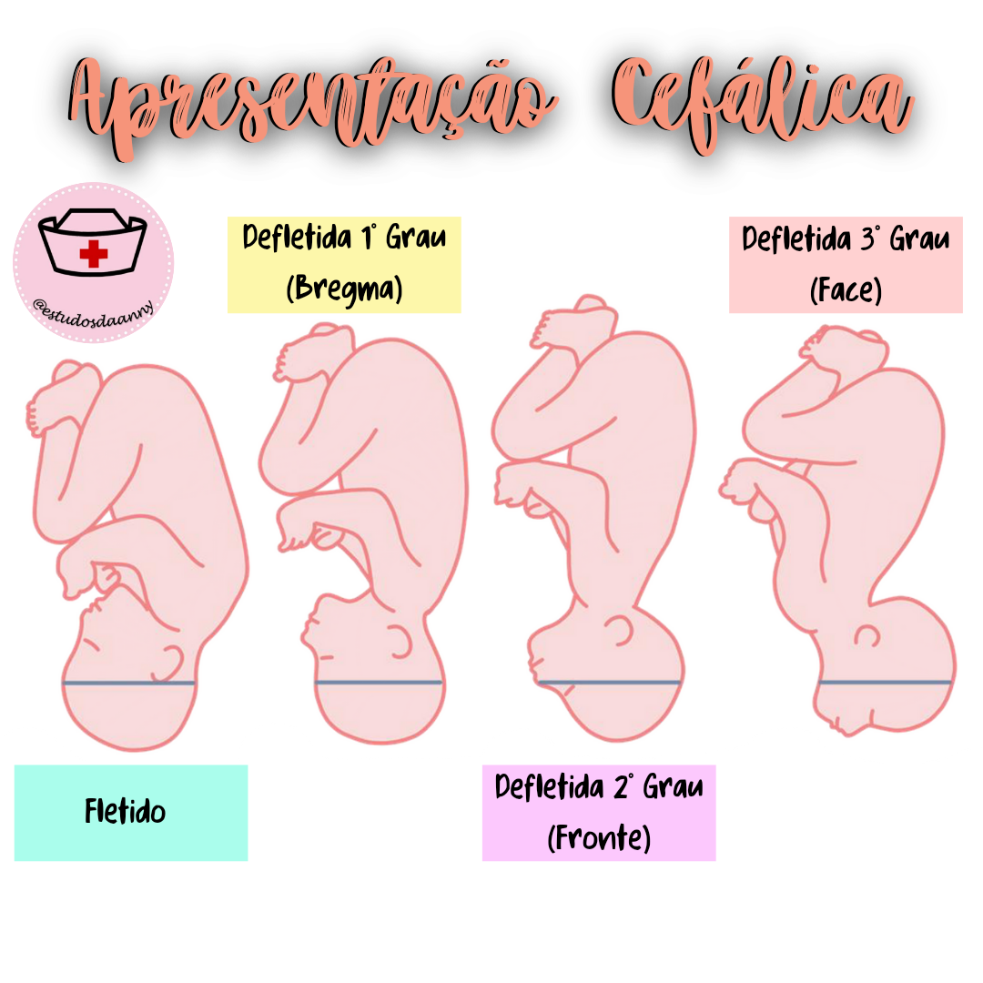 Apresentação Cefálica Com Dorso A Esquerda - BRAINCP