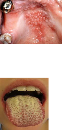 tan injections melanotan What are 'melanotan' injections? Explaining the controversial tanning drug