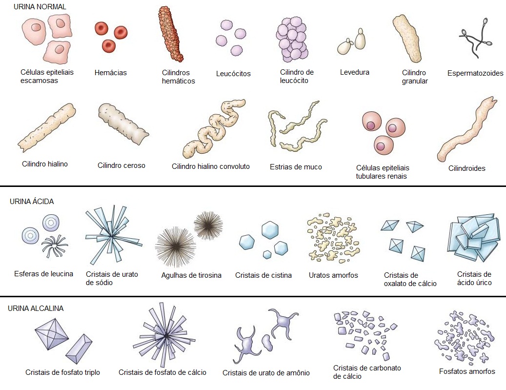 Cristallurie Urinaria Pdf M thodes D analyse Du S diment Urinaire