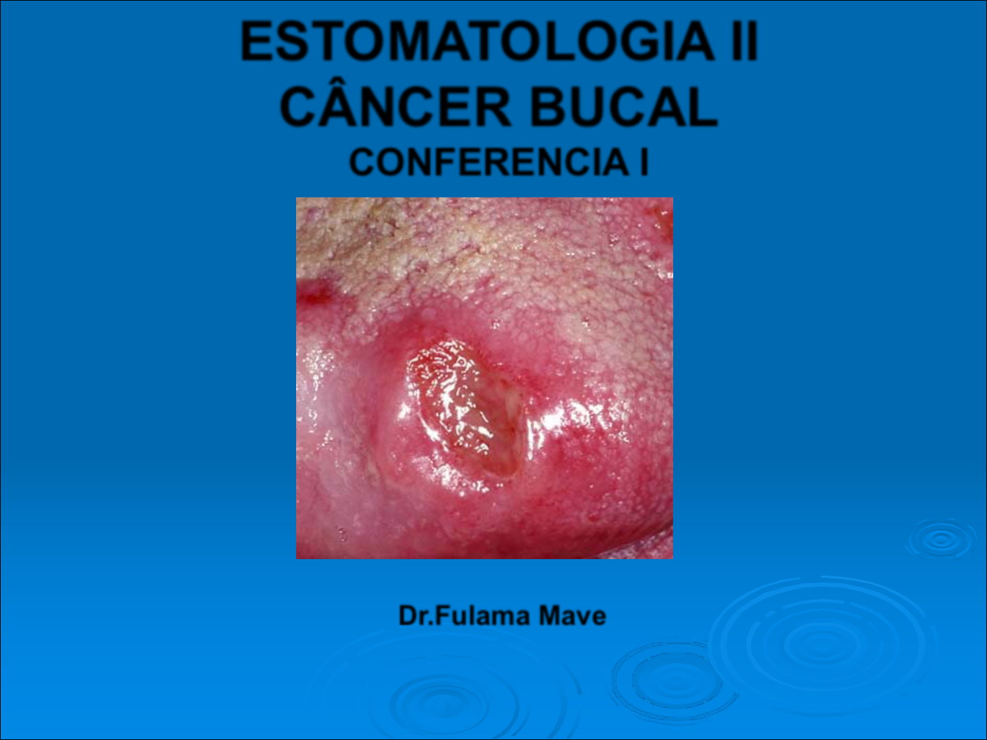 Grátis: Cancer bucal - Material Claro e Objetivo em PDF para Estudo Rápido, image size:1440x1080