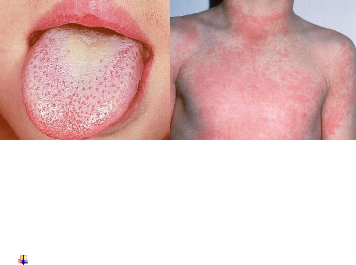 Doencas Exantematicas Elisamara Epidemiologia