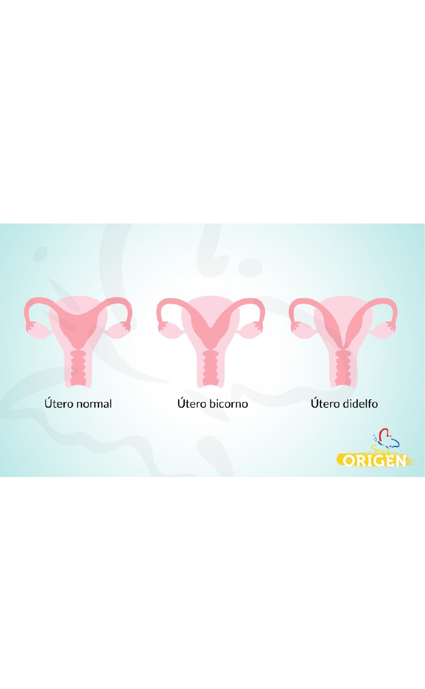 Grátis: TIPOS DE ÚTERO - Material Claro e Objetivo em PDF para Estudo Rápido