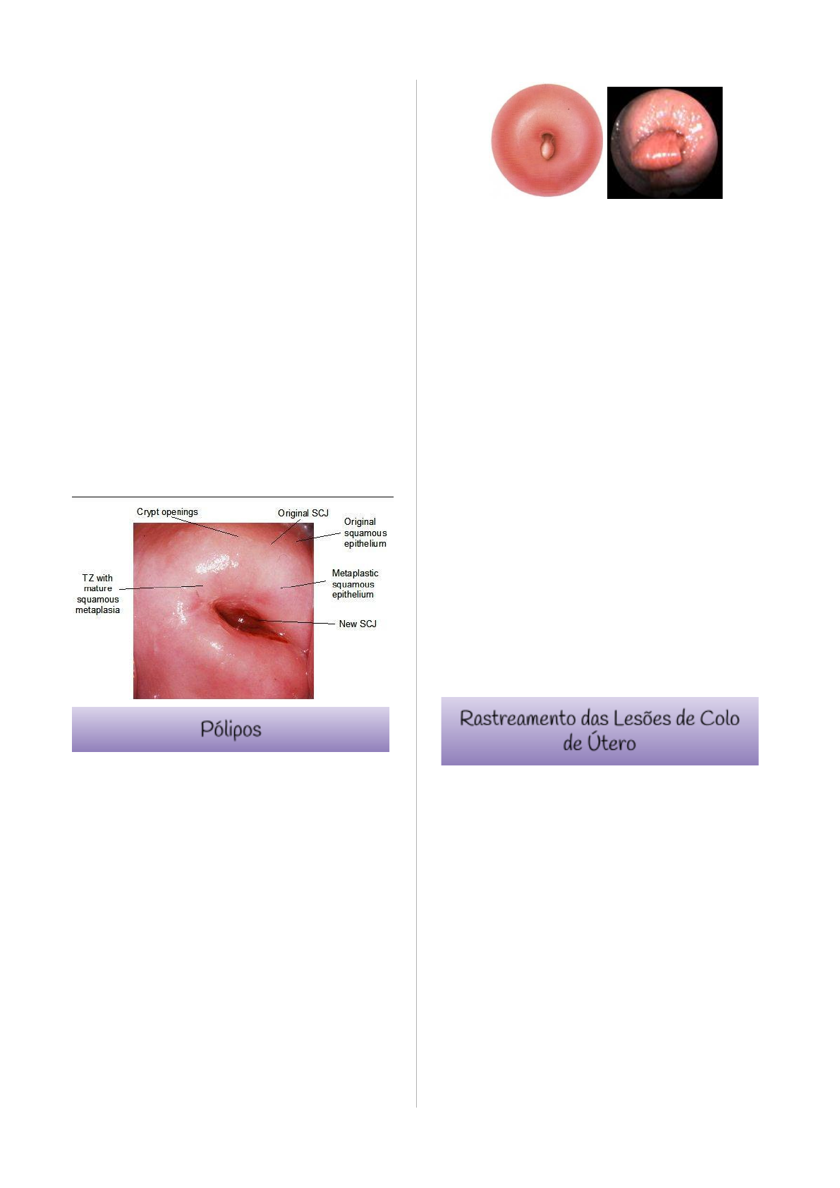 Grátis: Lesões de Colo Uterino - Material Claro e Objetivo em PDF para  Estudo Rápido