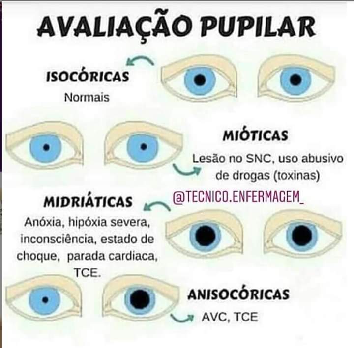 Pupilas Fisiologia Humana I