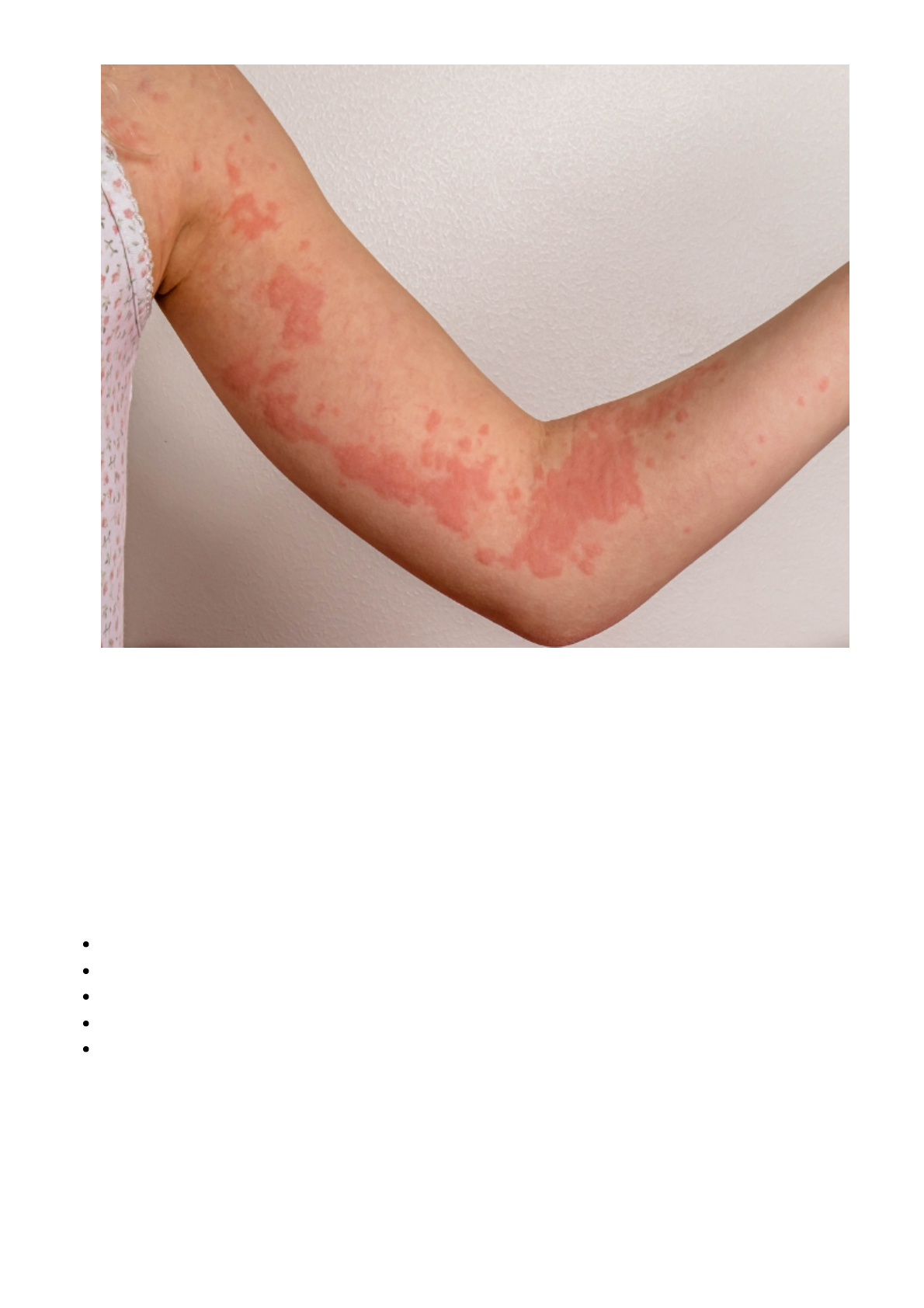 Picada de animal minúsculo presente em pets pode trazer consequências  irreversíveis a humanos; entenda, image size:1190x1684