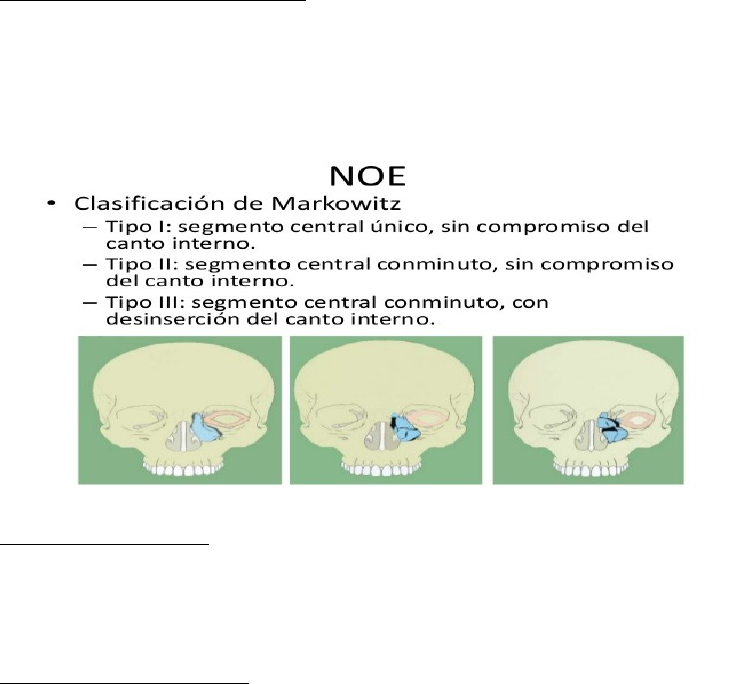 noe fractura