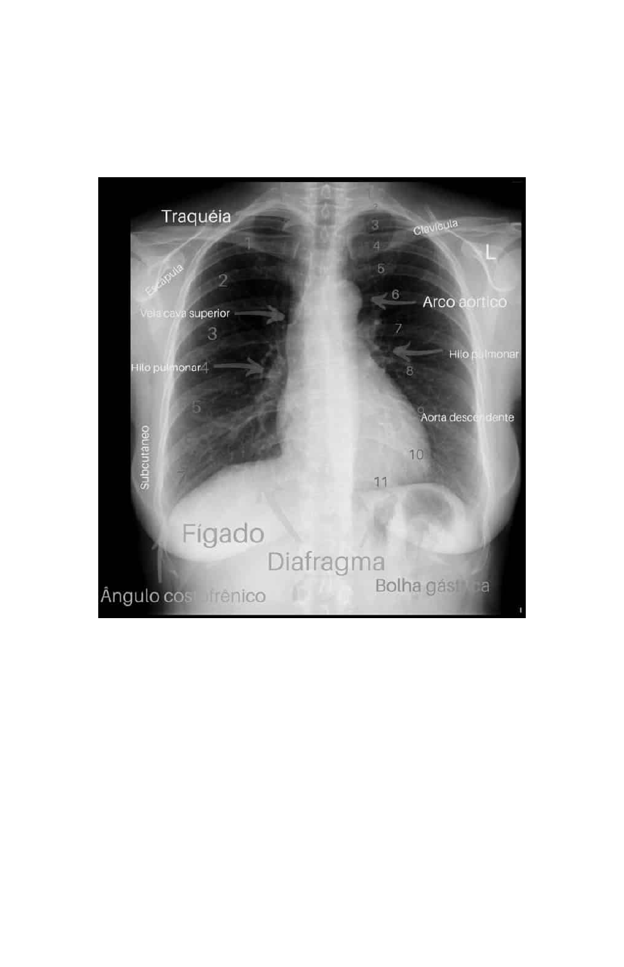 Imagem Cardiovascular, image size:902x1397